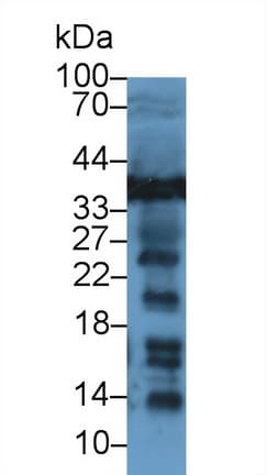 LDHB / Lactate Dehydrogenase B Antibody (aa1-334, Cy3)