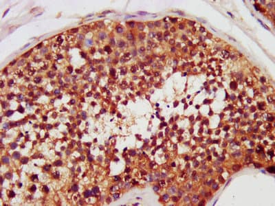 Polyclonal Rabbit anti-Human CHEK2 / CHK2 Antibody (WB)