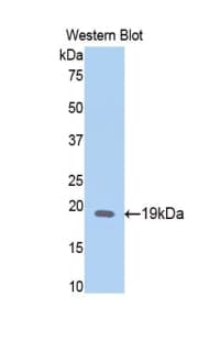 HPSE / Heparanase Antibody (aa40-188)