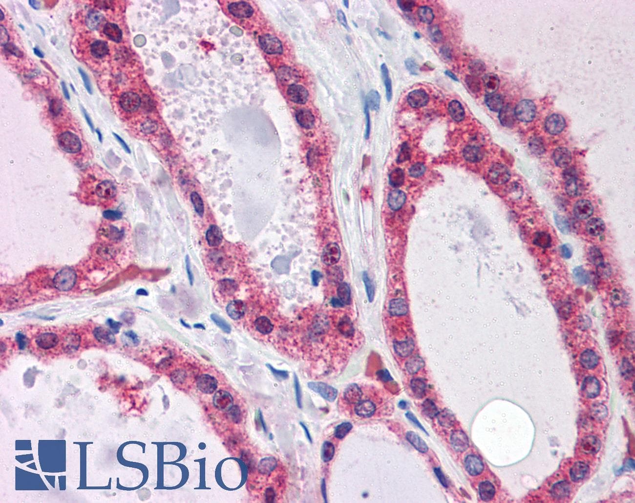 IHC-plus™ KCNN2 Antibody (aa545-557)
