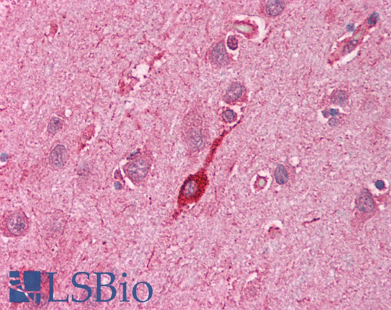 Polyclonal Rabbit anti-Human HMOX2 / Heme Oxygenase 2 Antibody (N-Terminus, IHC, WB)
