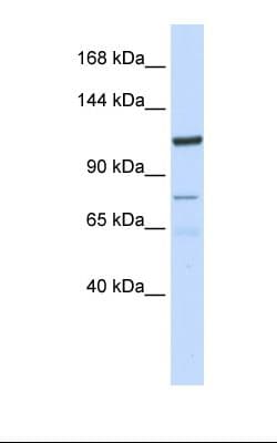 Polyclonal Rabbit anti-Human KIAA1324 / maba1 Antibody (aa110-159, IHC, WB)
