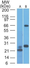 Monoclonal Mouse anti-Human VISA / MAVS Antibody (clone 58N3B6, aa93-276, IHC, WB)