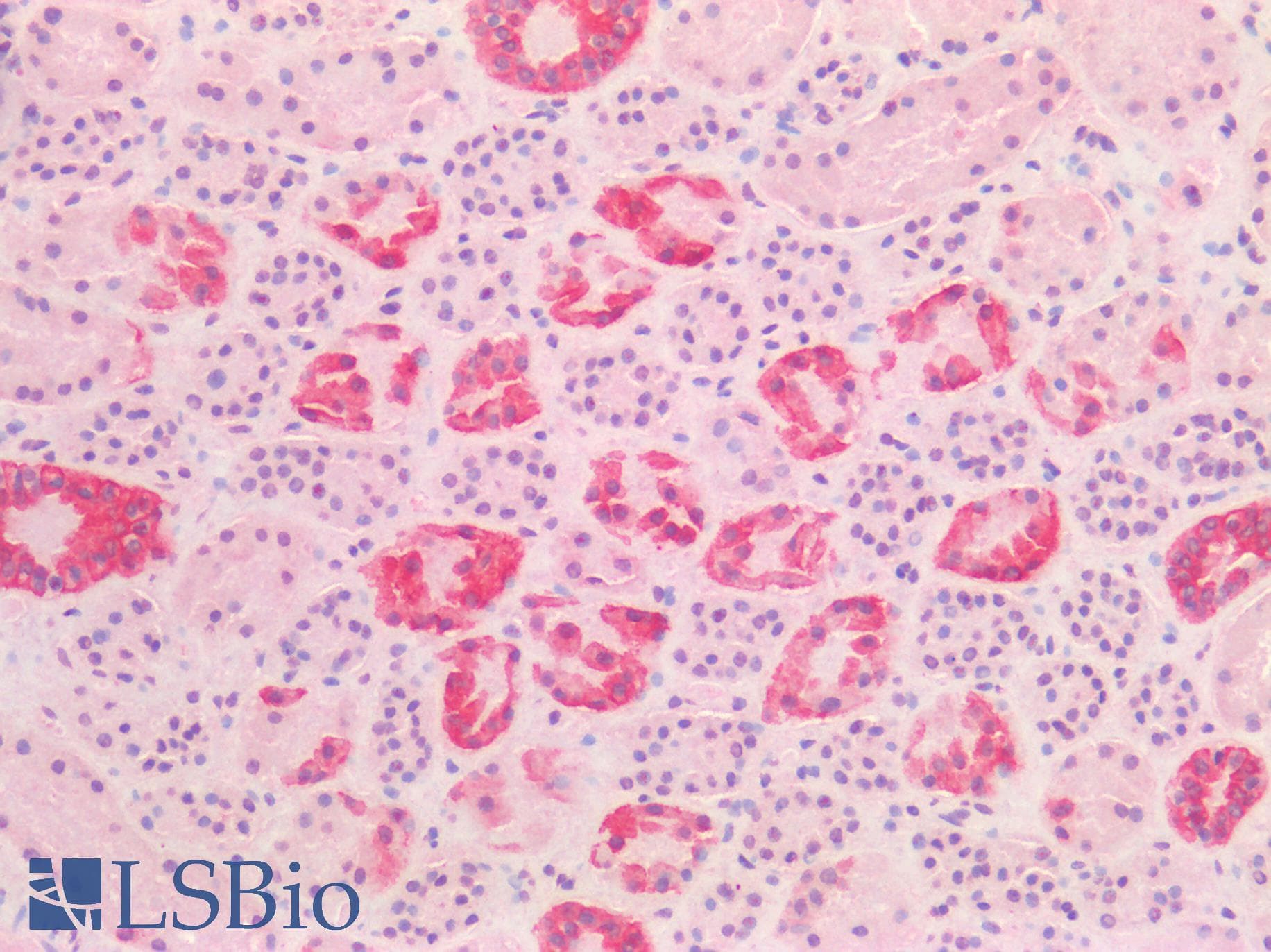 PathPlus™ Polyclonal Goat anti-Human KRT19 / CK19 / Cytokeratin 19 Antibody (aa385-398, IHC, WB)