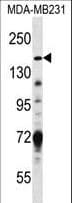 Polyclonal Rabbit anti-Human Hamartin / TSC1 Antibody (aa401-430, IHC, IF, WB)