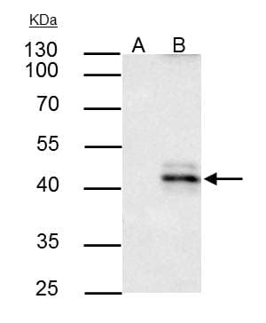 IHC-plus™ Polyclonal Rabbit anti-Human HLA-A Antibody (IHC, WB)