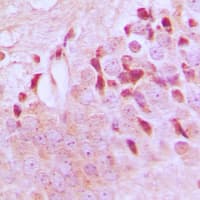 Tuberin / TSC2 Antibody (phospho-Thr1462)