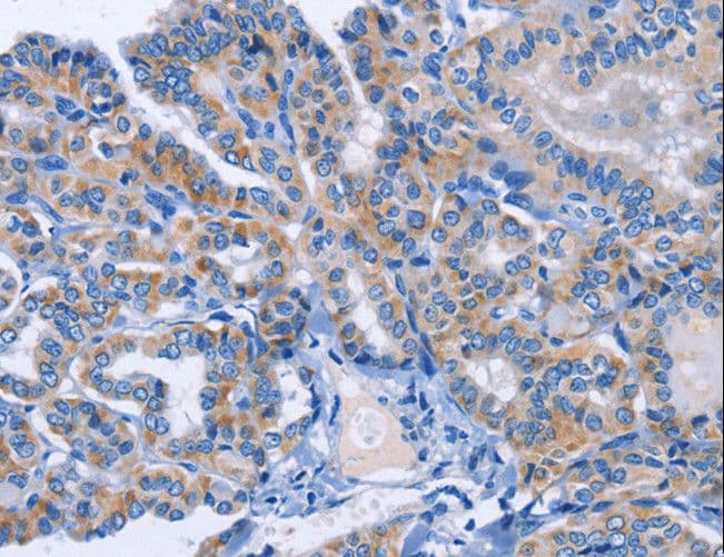 AMACR / P504S Antibody