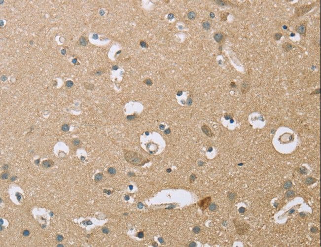 SCEH / ECHS1 Antibody