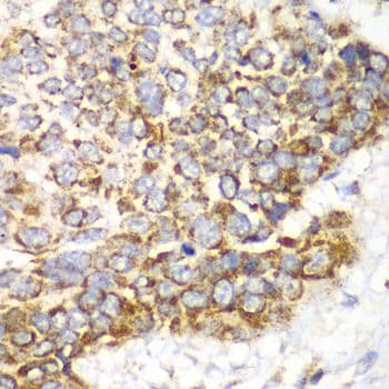 MtTFA / TFAM Antibody