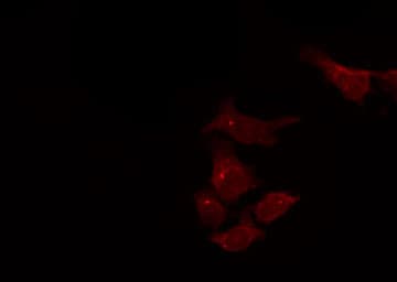 Polyclonal Rabbit anti-Human DHRS4 / PSCD Antibody (IHC, IF, WB)