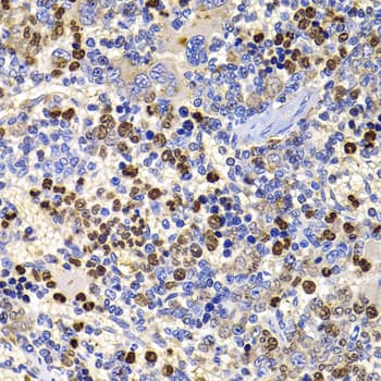UBASH3B / STS-1 Antibody