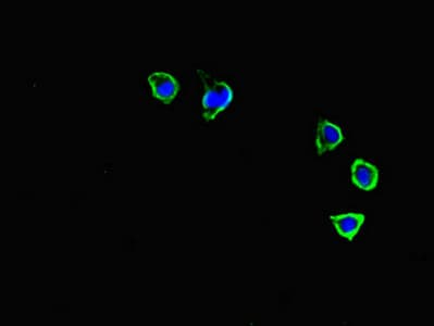 Polyclonal Rabbit anti-Human CXCR3 Antibody (IHC, IF, WB)