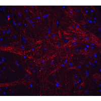 Polyclonal Rabbit anti-Human TNFSF12 / TWEAK Antibody (IHC, IF, WB)