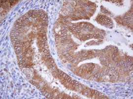 IDH1 / IDH Antibody (clone OTI1D1)