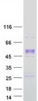 Human PCOLCE Protein (Recombinant Myc-DDK (Flag))