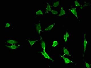 Polyclonal Rabbit anti-Human TNFAIP3 / A20 Antibody (IF, WB)