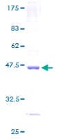 Human PMAIP1 / NOXA Protein (Recombinant GST)
