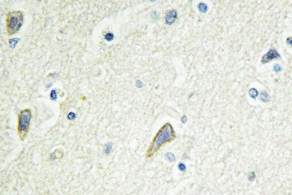 IHC-plus™ EPHB4 / EPH Receptor B4 Antibody (aa580-630)
