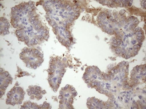 SSX2IP Antibody (aa1-272, clone OTI5C3)