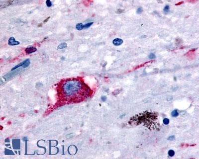 PathPlus™ Polyclonal Rabbit anti-Human NPBWR2 / GPR8 Antibody (N-Terminus, IHC)