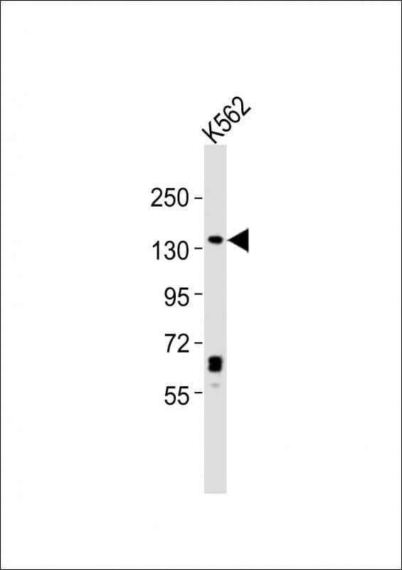 SYNJ1 / Synaptojanin Antibody (aa1517-1551)