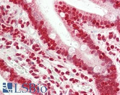 IHC-plus™ Polyclonal Rabbit anti-Human MLXIP / MONDOA Antibody (aa72-100, IHC, WB)