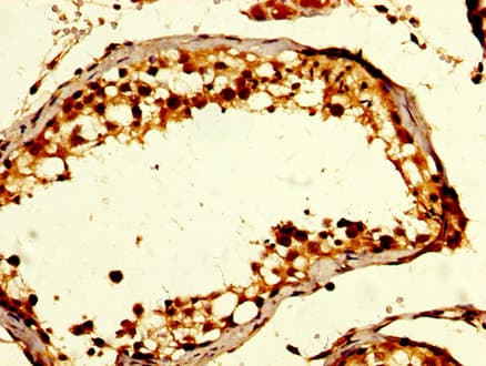 GDF10 / BMP3B Antibody