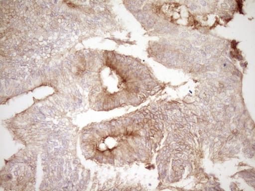 PROCR / EPCR Antibody (aa1-210, clone OTI3E7)
