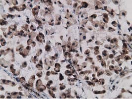 Monoclonal Mouse anti-Human Gephyrin Antibody (clone OTI3B6, IHC, IF, WB)