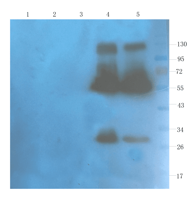 CD40L Antibody (CD40L, clone hu5c8 (Ruplizumab))