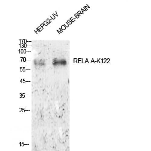 RELA / NFKB p65 Antibody (Acetyl-Lys122)