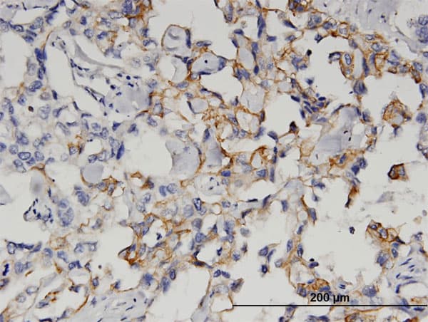 Monoclonal Mouse anti-Human QPCT / QC Antibody (clone 3G2, IHC)