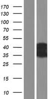 CT47A6 Protein (Over-Expression Lysate Myc-DDK (Flag))