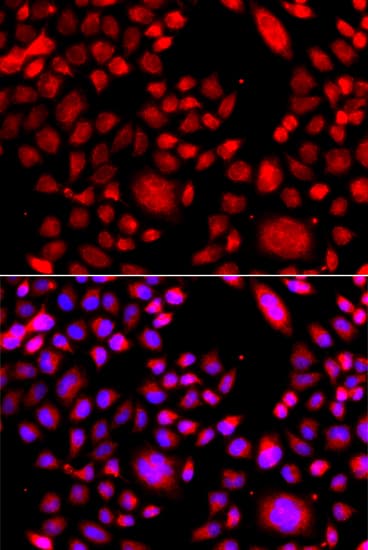 RAC3 Antibody