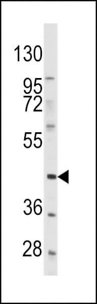 Polyclonal Rabbit anti-Human PRLTS / PDGFRL Antibody (aa328-357, IHC, WB)