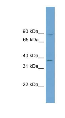 GTF2A1 / TFIIA Antibody (aa215-264)