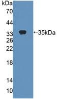 Carboxylesterase 1 / CES1 Antibody (aa19-300)