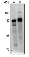 BUB1B / BubR1 Antibody