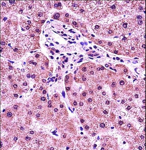 HIST1H1E Antibody (aa1-30)