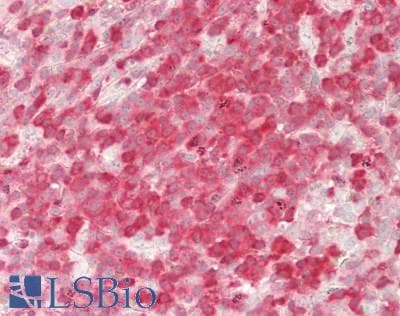 IHC-plus™ PRDX2 / Peroxiredoxin 2 Antibody