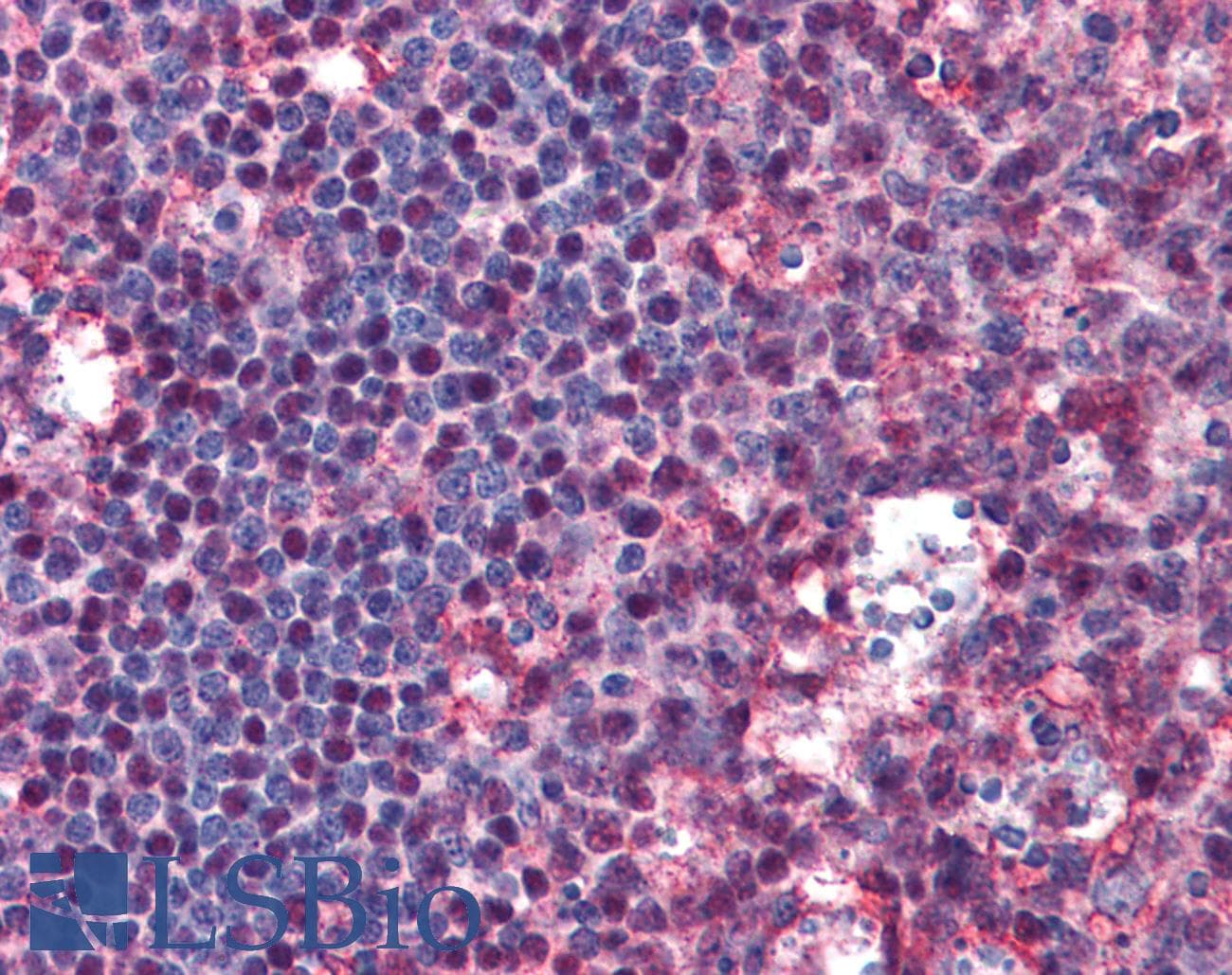 IHC-plus™ CREB1 / CREB Antibody (clone 5F2)