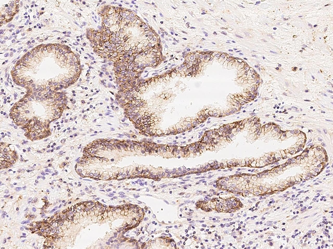 SLC1A5 / ASCT2 Antibody