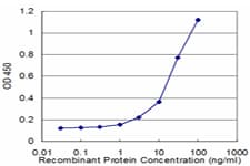 Monoclonal Mouse anti-Human HLA-DQB2 Antibody (clone 4C3, WB)