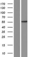 DGAT1 Protein (Over-Expression Lysate Myc-DDK (Flag))