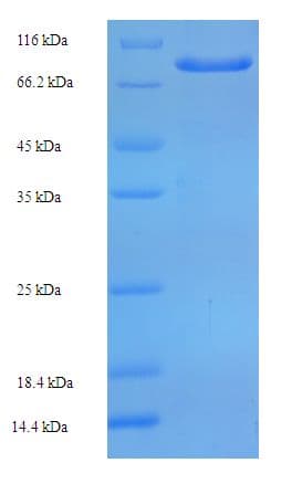 Human ZNF165 Protein (Recombinant His-SUMO)