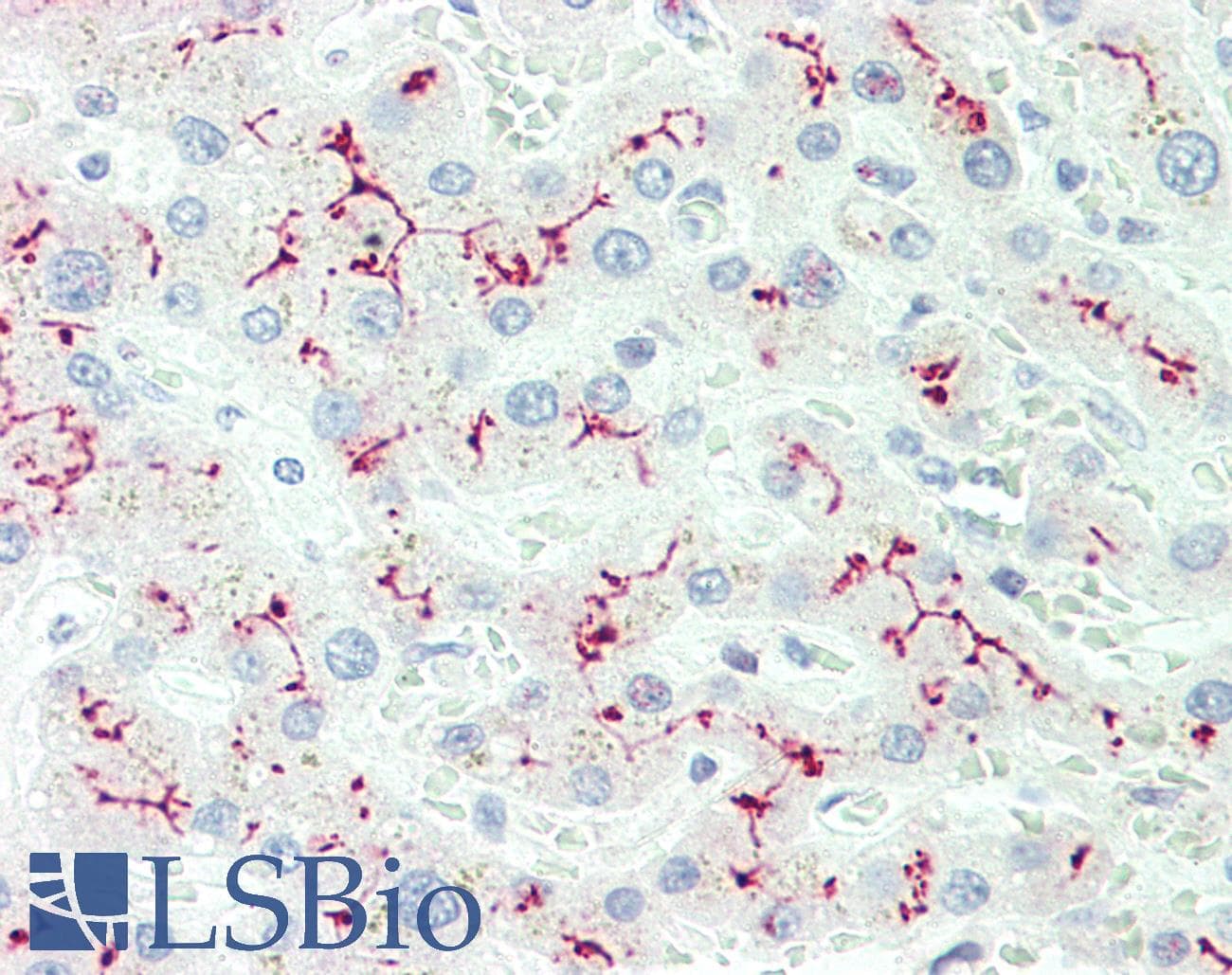 IHC-plus™ IL12RB2 Antibody (aa756-783)