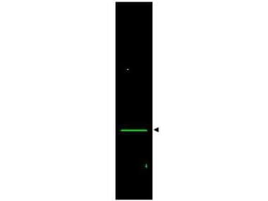 Polyclonal Rabbit anti-Human VDAC1 / PORIN Antibody (IHC, WB)