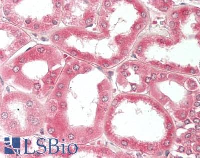IHC-plus™ Polyclonal Rabbit anti-Human RPLP2 Antibody (aa13-41, IHC, WB)