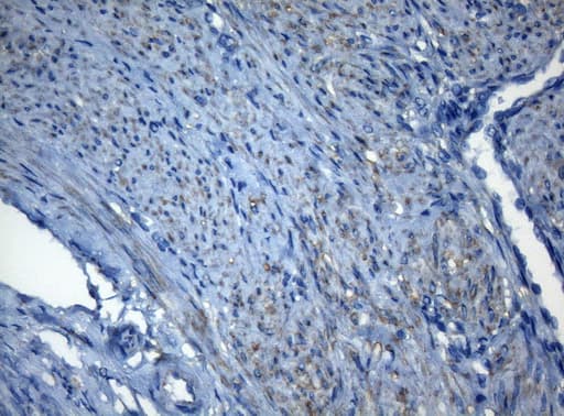 ZNF217 Antibody (aa730-1048, clone OTI3G5, Carrier-free)
